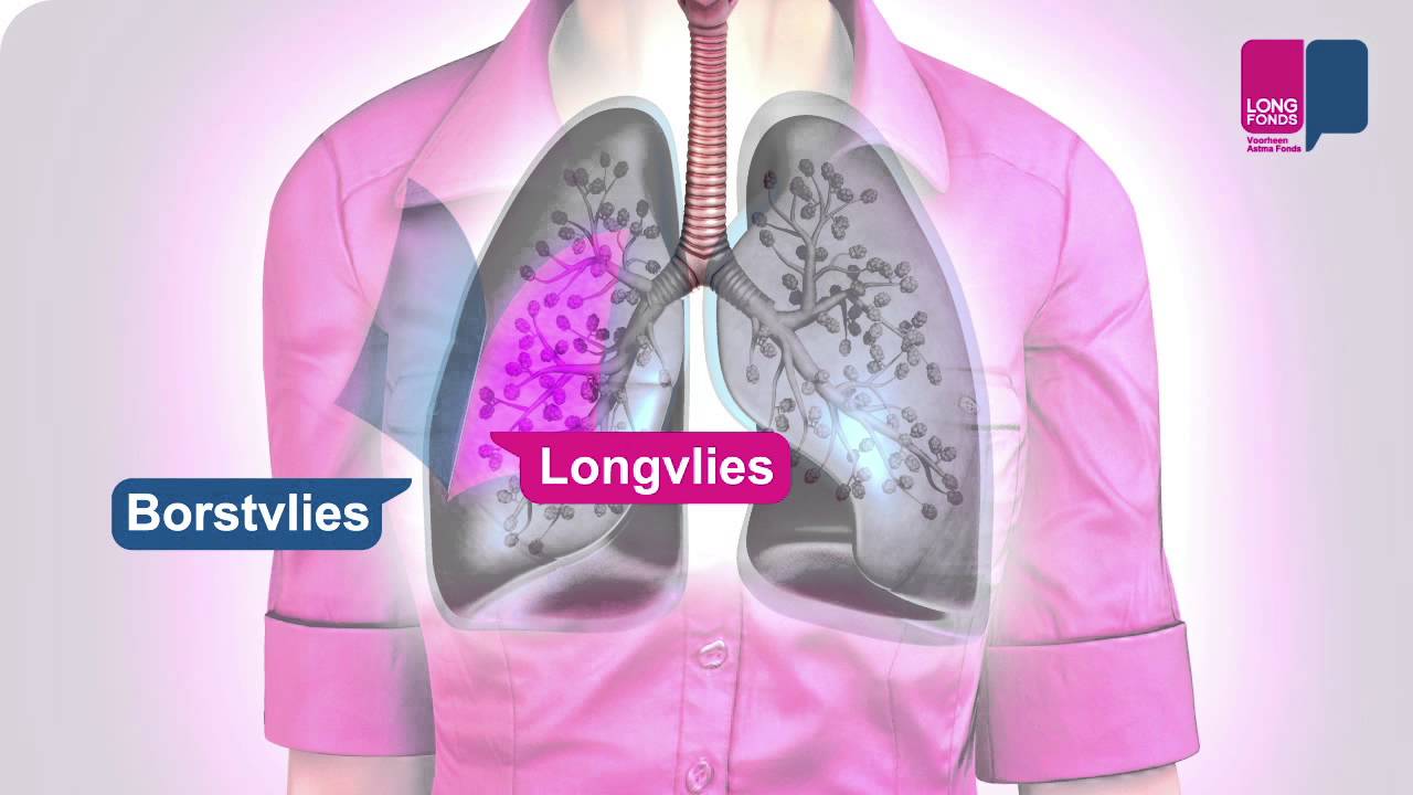 Pleuritis - wat gebeurt er in je longen? - YouTube - Druk Op De Borst En Kortademig