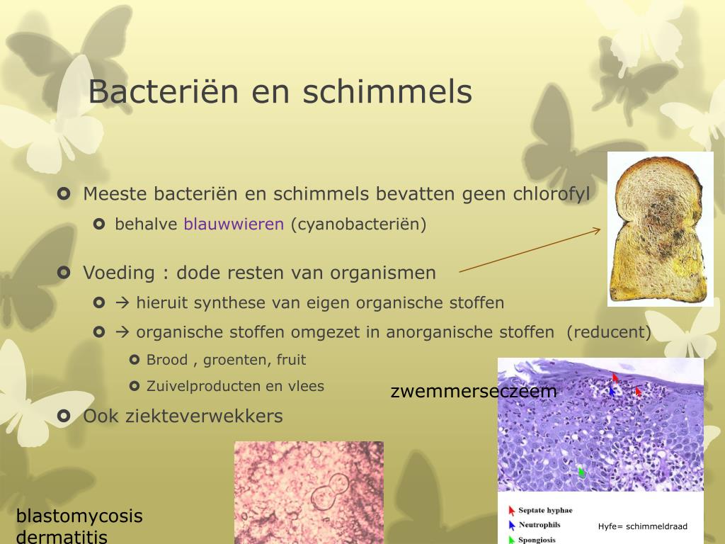 PPT - 3. Bacteriën en schimmels PowerPoint Presentation, free download - Welke Celkenmerken Heeft De Schimmel Die Roos Veroorzaakt