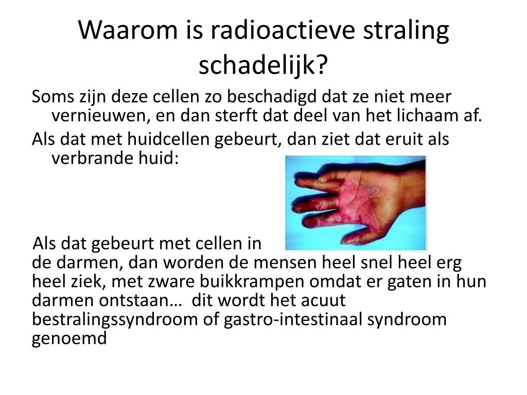 PPT - Radioactiviteit en de mogelijke gevolgen voor mensen PowerPoint - Wanneer Is Radioactieve Straling Gevaarlijk