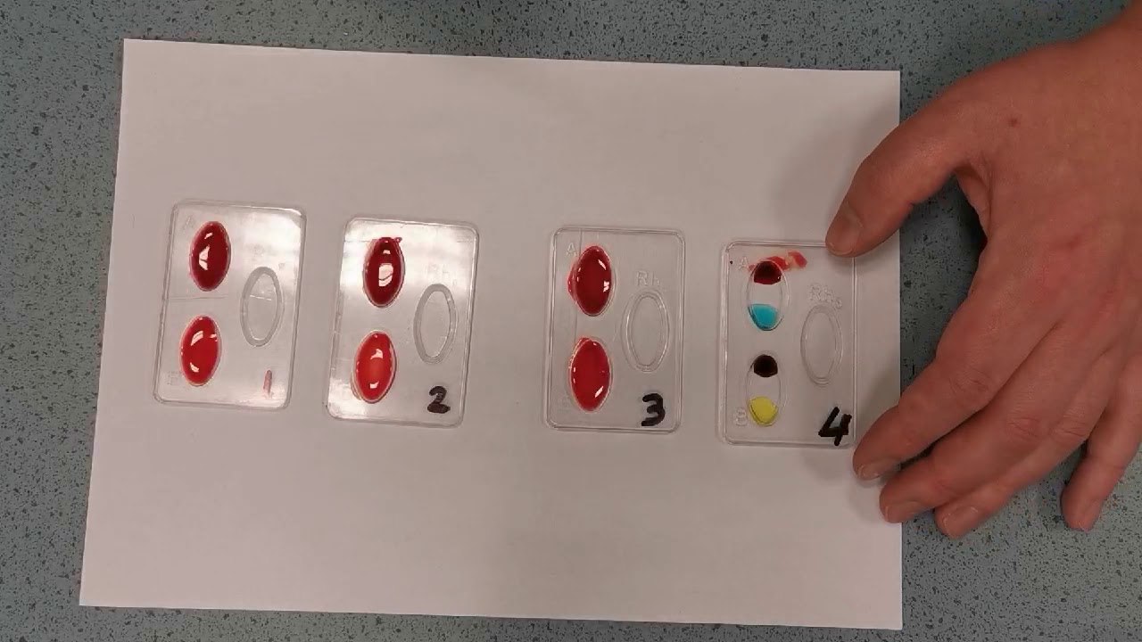 Practicum bloedgroepen bepalen - YouTube - Hoe Kun Je Bepalen Of Iets Een Organisme Is