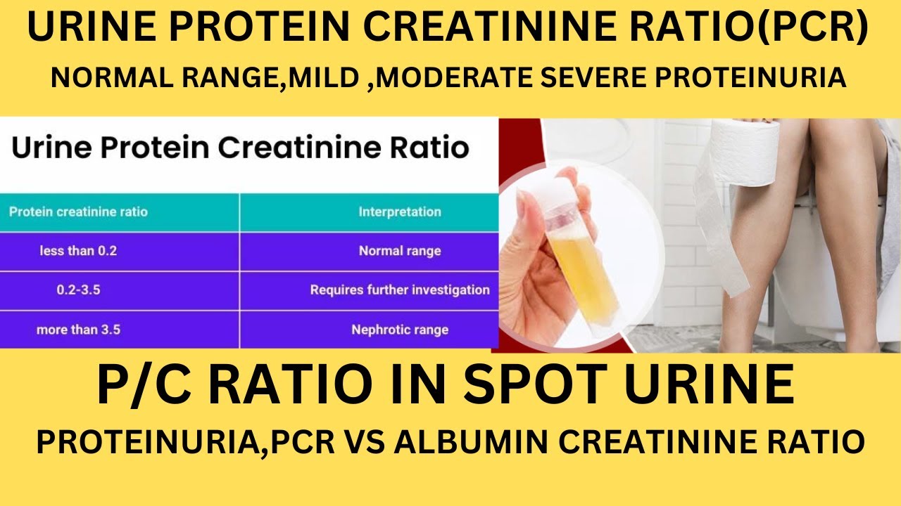 PROTEIN CREATININE RATIO TEST IN URINE.P/C RATIO IN SPOT URINE NORMAL - Wat Zegt Creatinine In Urine
