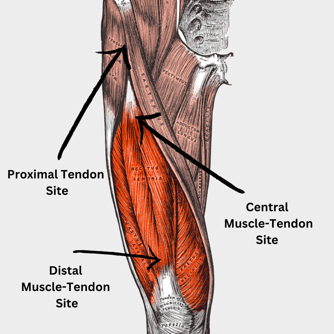 Quadriceps Muscle Diagram - Quadriceps Oefeningen Zonder Knie Te Belasten