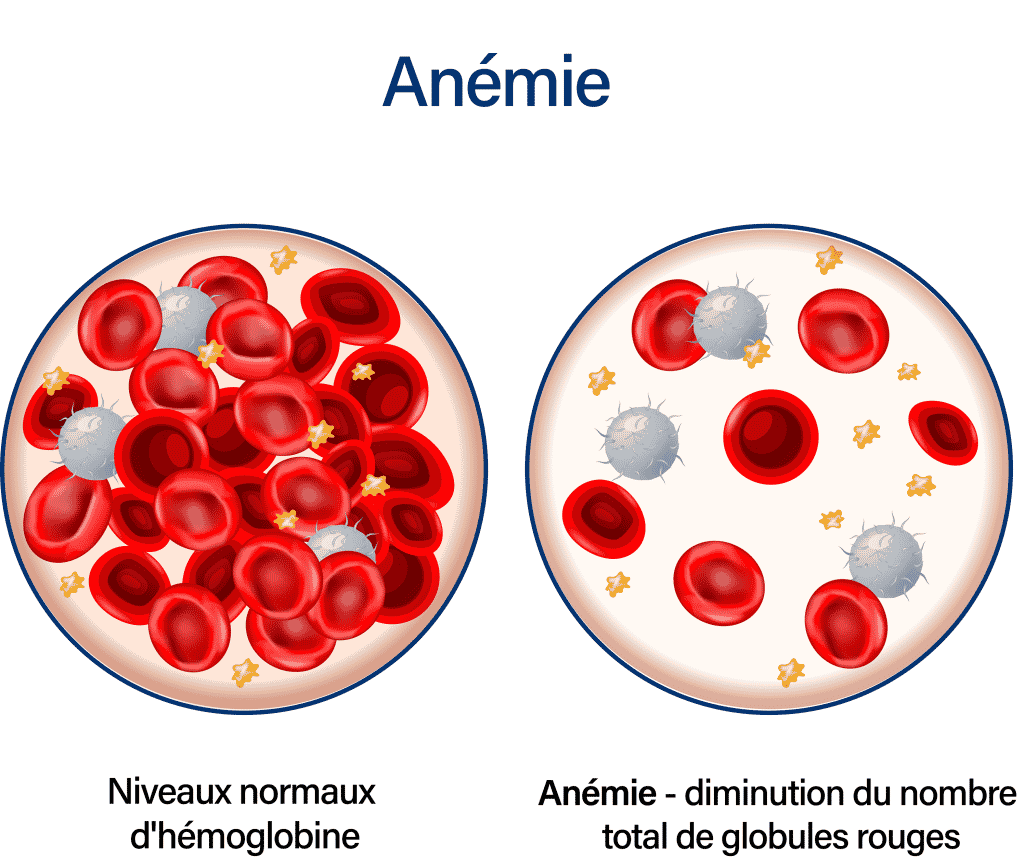 Anemie Protocol Doortesten Bij Verlaagd Hb