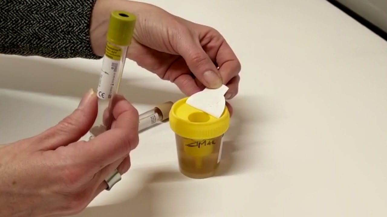 RECUEIL URINES MEDLAB - YouTube - Bacteriën In Urine Op Kweek