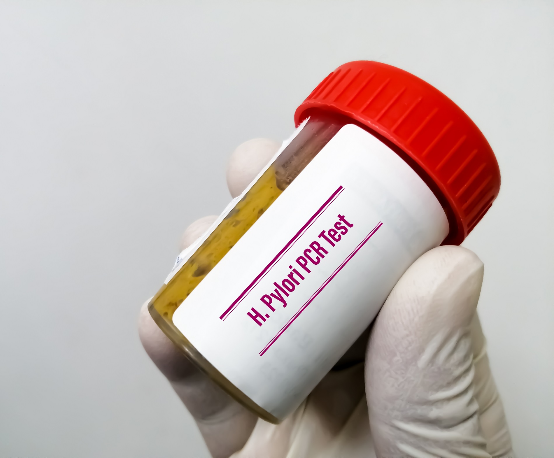 Red Helicobacter Pylori - Red Canaria Laboratorios - Helicobacter Pylori Hoe Kom Je Eraan