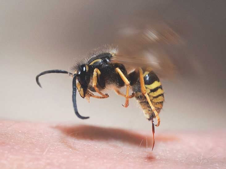 Red Wasp Sting Swelling - Hoe Ziet Een Wespensteek Eruit