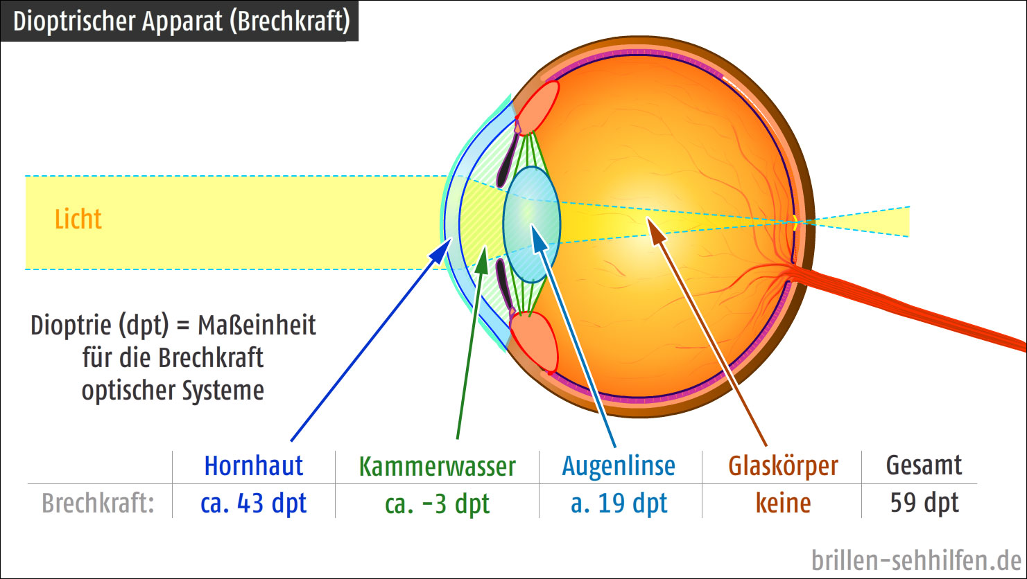 Sehstärke (Visus) und Dioptrien - Unterschied und Umrechnung - Visus Oogkliniek Utrecht - Ooglaseren Utrecht