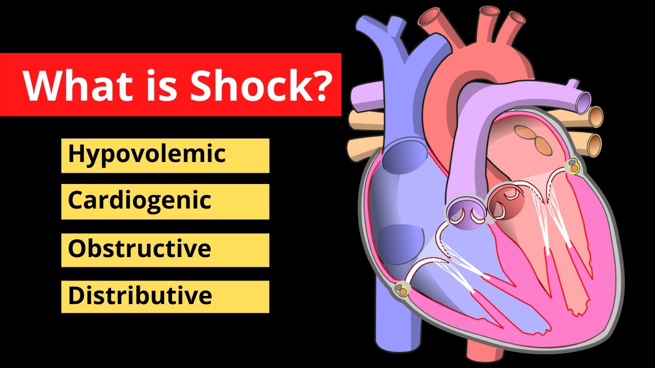 Wat Is De Belangrijkste Oorzaak Van Shock