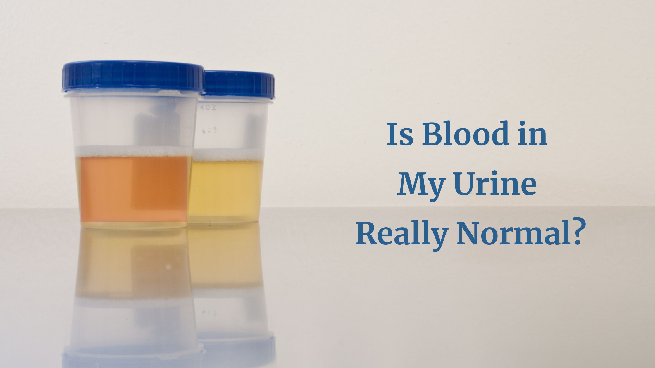 Bloed In Urine Maar Geen Blaasontsteking