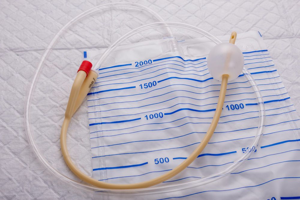 Sonde de Foley : à quoi ça sert ? Définition - Sonde Doorspoelen Met Water Filmpje