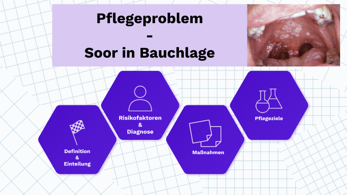Soor in Bauchlage by Kreuz Kreuzbube on Prezi - Wat Is Een Semi Gestructureerd Interview