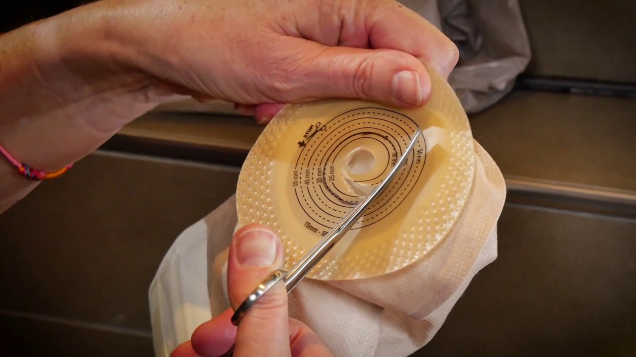 Stoma instructiefilmpje eendelig ileostoma - YouTube - Wanneer Krijg Je Een Stoma