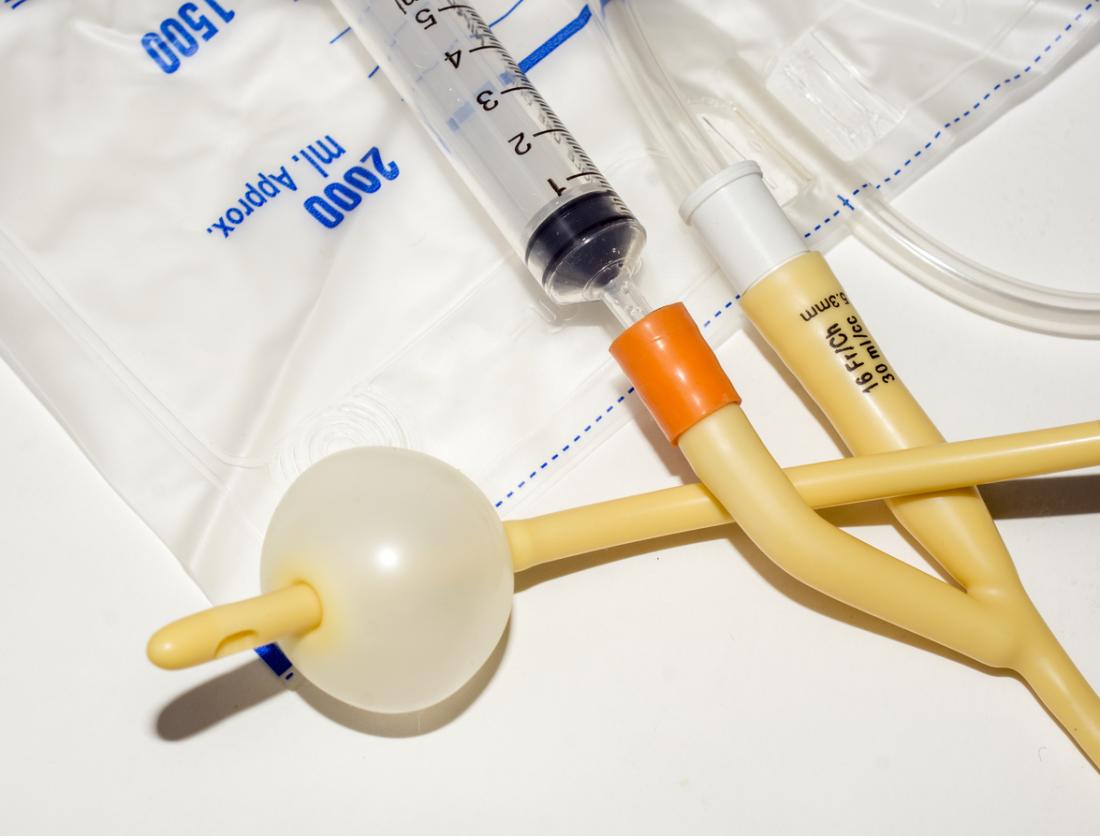 Suprapubic catheters: Uses, care, and what to expect - Katheter Inbrengen Man Protocol Vilans