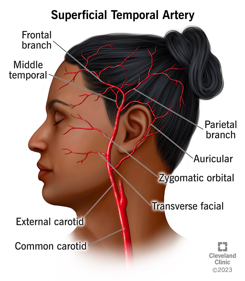 Surgical Anatomy Of The Superficial Temporal Artery To, 51% OFF - Arteria Cerebri Media Infarct Symptomen