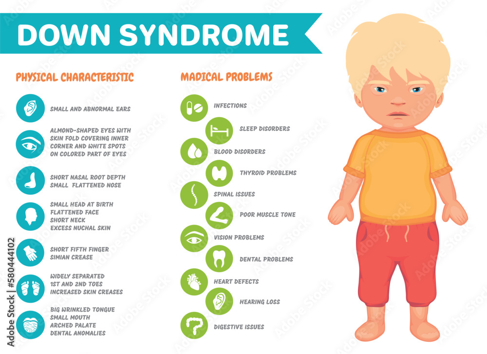Symptoms of down syndrome vector infographic poster Stock Vector - Hoe Ontstaat Syndroom Van Down