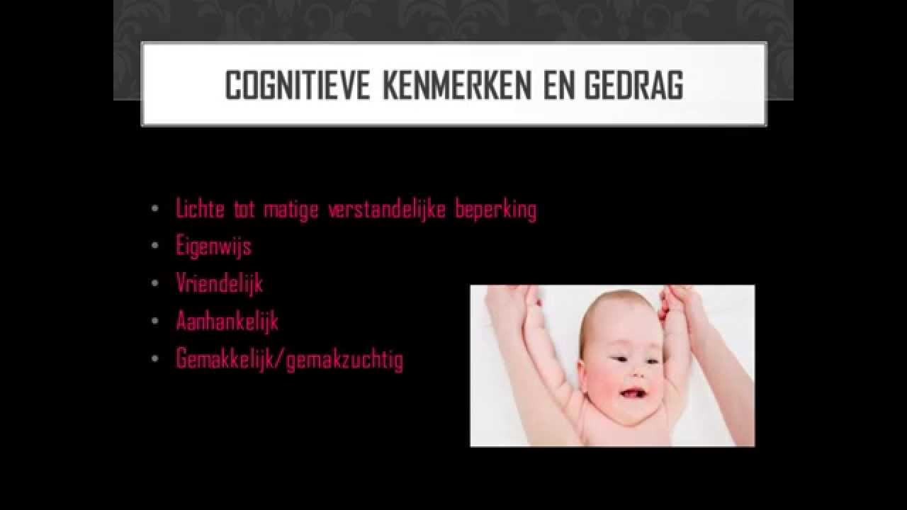 Kenmerken Van Syndroom Van Down