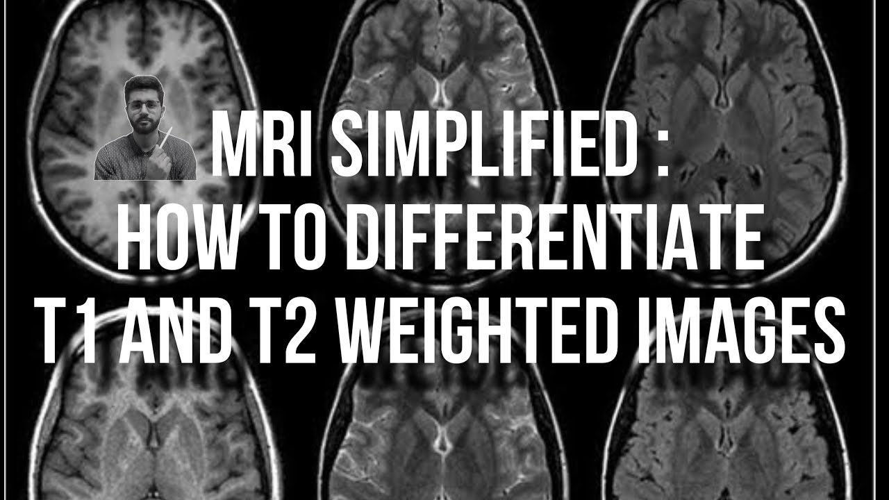 T1 vs T2 weighted images in MRI - YouTube - Verschil T1 En T2 Mri