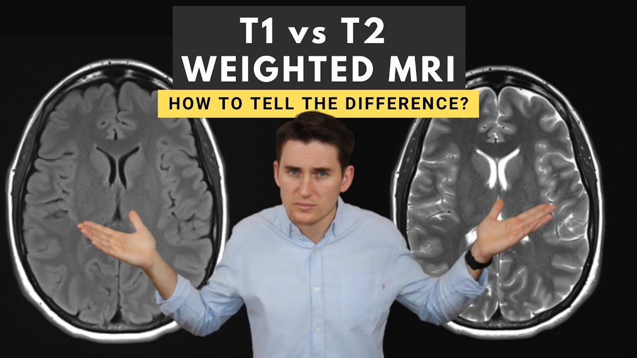 T1 vs T2 weighted MRI images: How to tell the difference - YouTube - Verschil T1 En T2 Mri