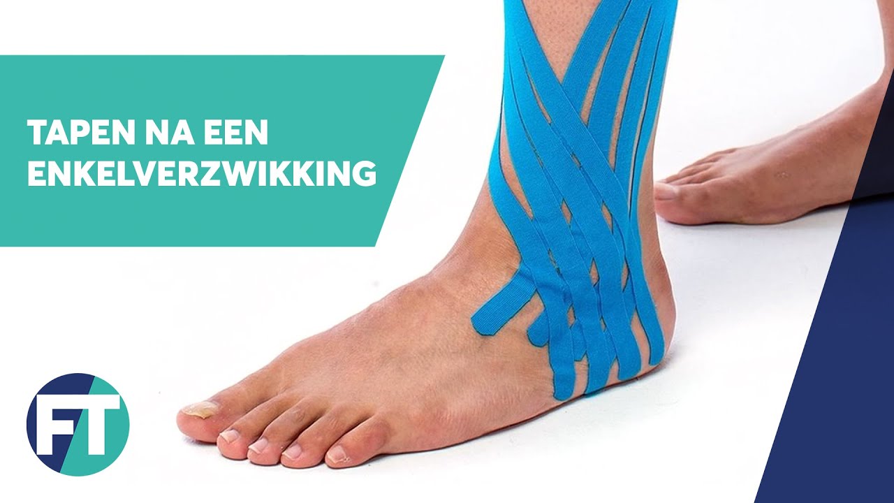 Tapen na een enkelverzwikking | Medical Taping | FysioTape - YouTube - Hoe Lang Koel Je Een Verstuiking