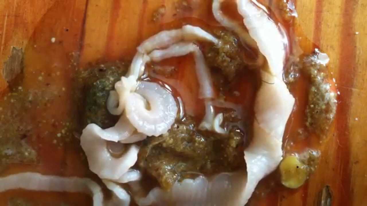 Mens Lintworm Witte Stukjes In Ontlasting