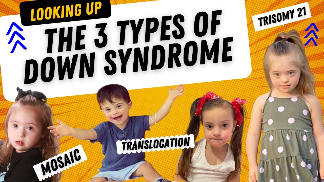 The 3 Types of Down Syndrome - YouTube - Hoeveel Chromosomen Heeft Een Lichaamscel
