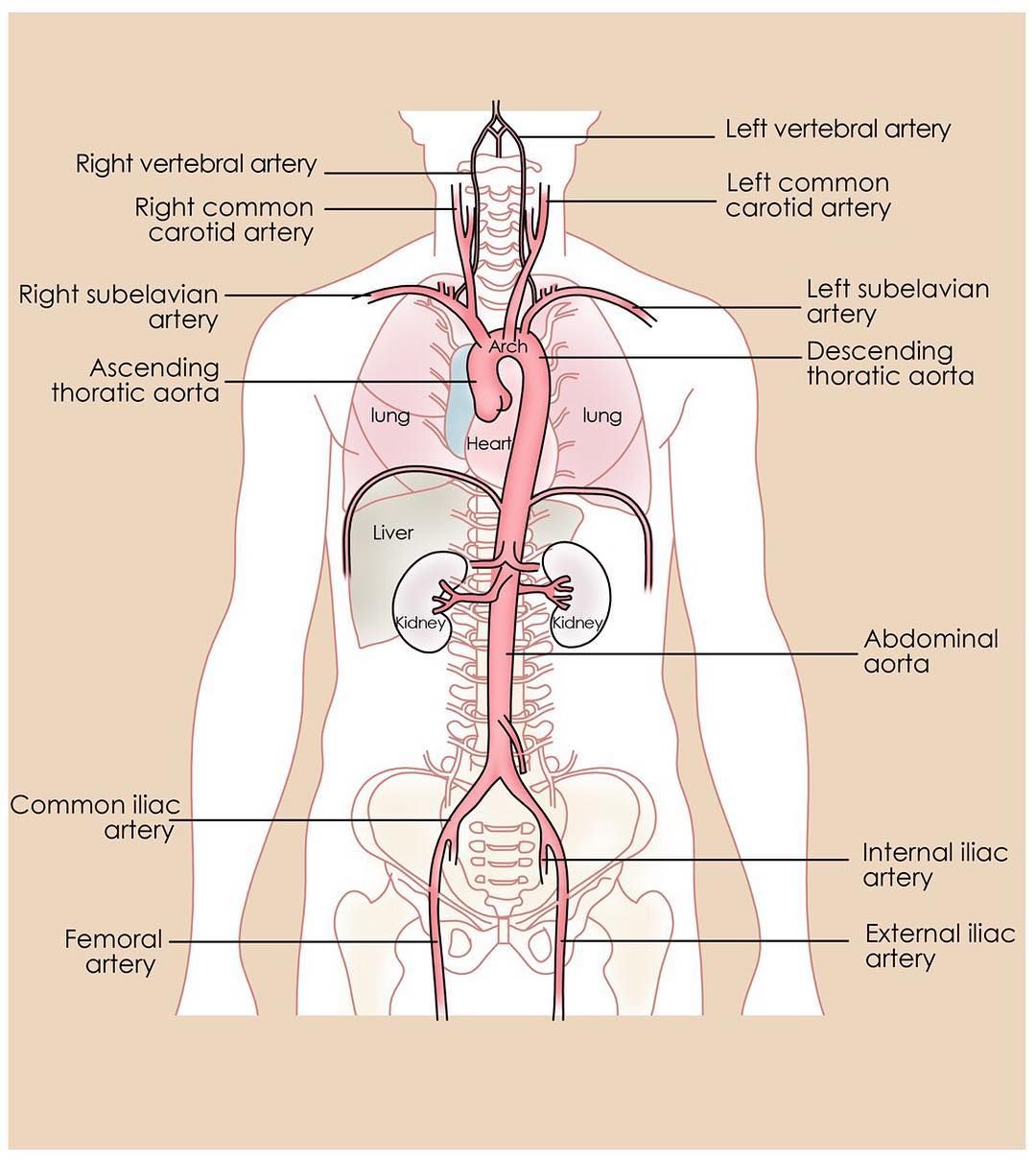 Vernauwing Aorta In De Buik