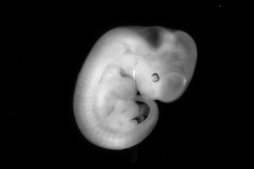 The Rockefeller University » Solving the mystery behind how nutrients - Wanneer Nestelt Een Embryo Zich In
