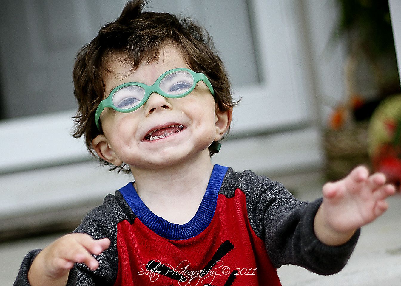 This is Vinny. He was born with Cornelia de Lange Syndrome. Please go - Syndroom Van Cornelia De Lange