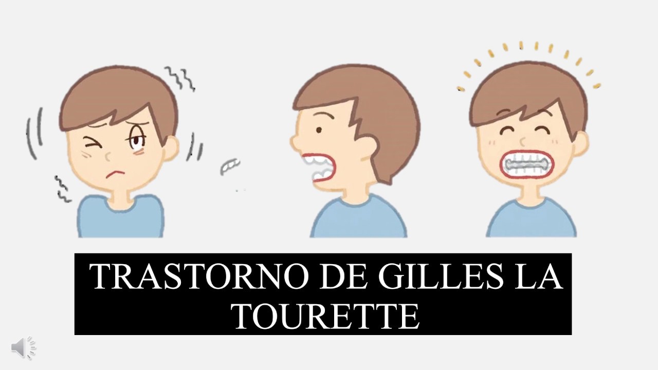Trastorno de Gilles de la Tourette - YouTube - Gil De La Tourette Schelden