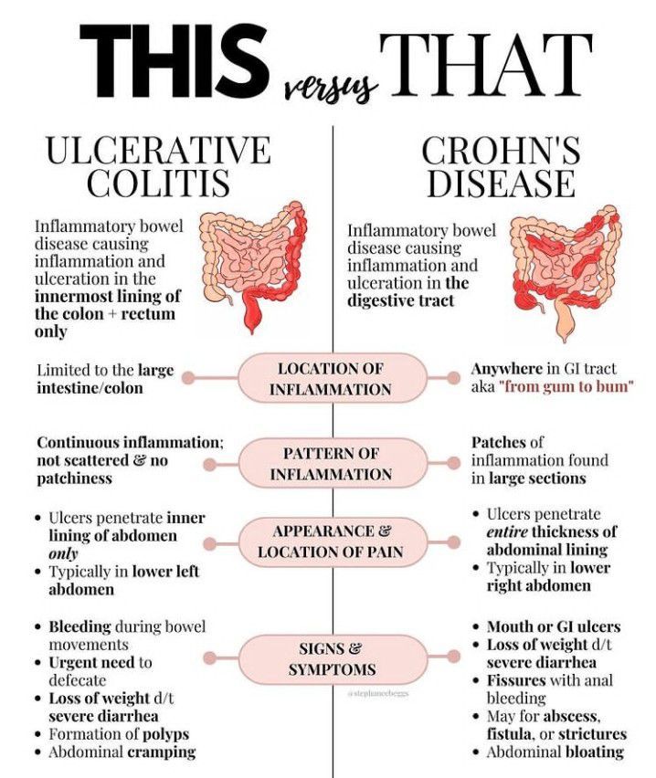 Ulcerative colitis vs crohns disease - MEDizzy - Verschillen Ziekte Van Crohn En Colitis Ulcerosa