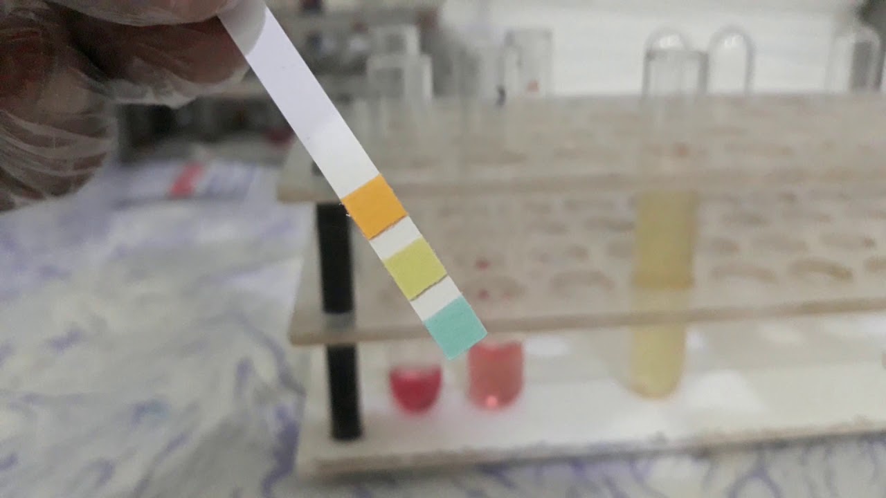 Urine Albumin Test - YouTube - Albumine In Urine Te Hoog