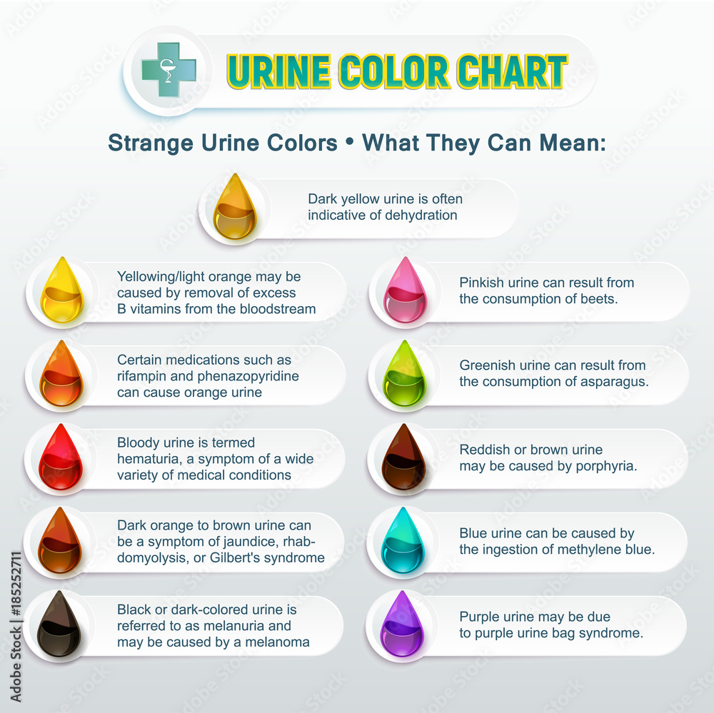 Urine Color Chart 2 Stock Vector | Adobe Stock - Wat Zegt De Kleur Van Urine