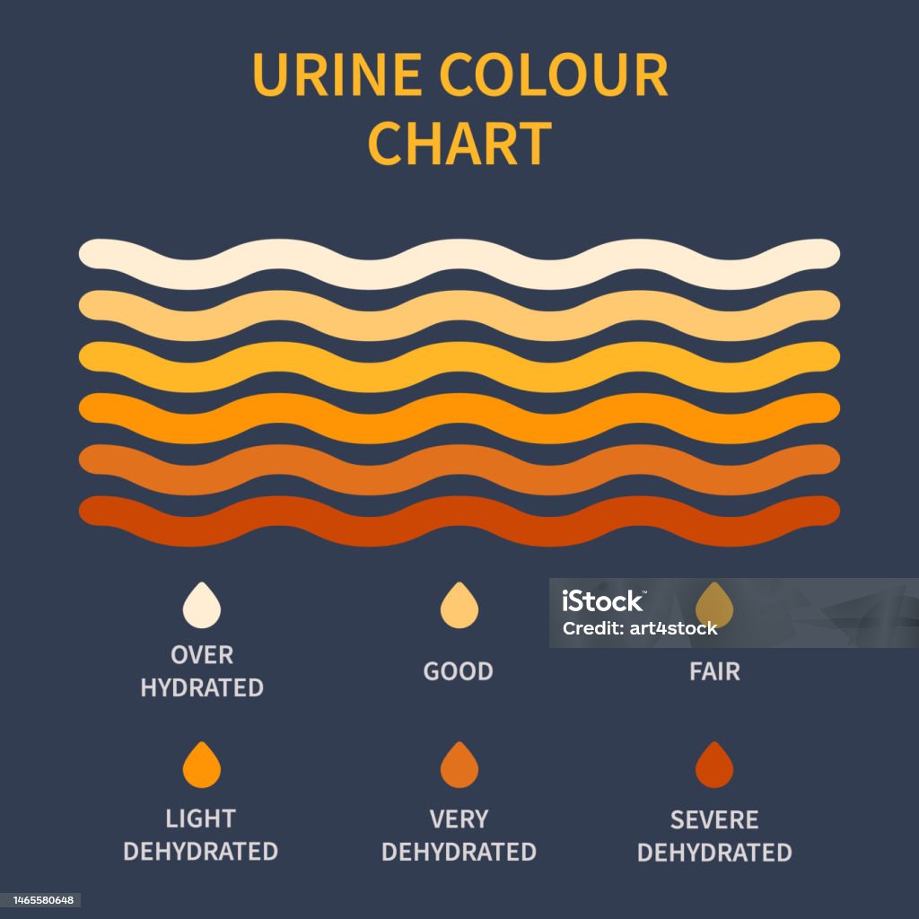 Urine Color Chart Illustration Of Dehydration Level Urine Colour Chart - Urine Uit Matras Oma Weet Raadt