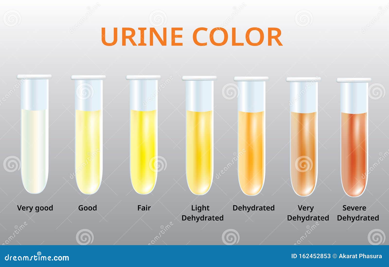 Welke Kleur Moet Urine Hebben