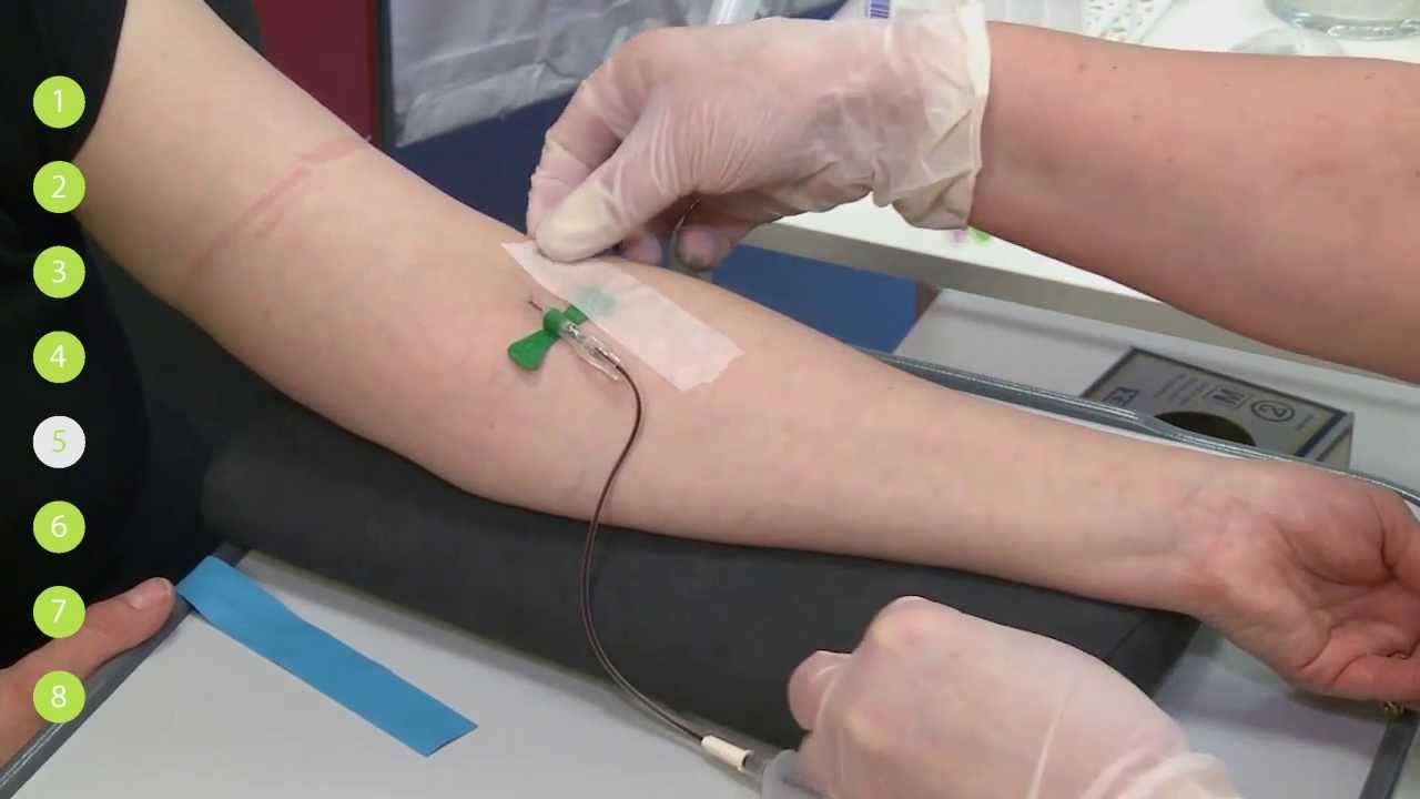 Venapunctie (TVP) Vleugelnaaldsysteem - YouTube - Hoe Lang Mag Een Vleugelnaald Blijven Zitten