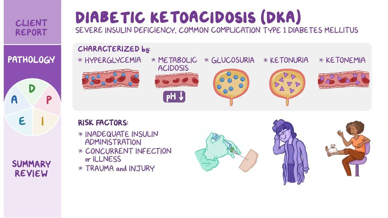 Video: Diabetic ketoacidosis (DKA): Nursing process (ADPIE) - Ketoacidose Bij Diabetes Type 2