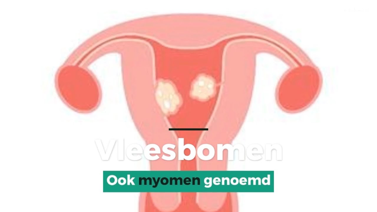 Myoom Dikke Buik Door Vleesboom