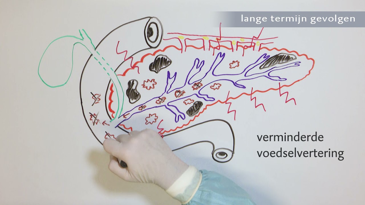 Wat Is De Functie Van Alvleesklier