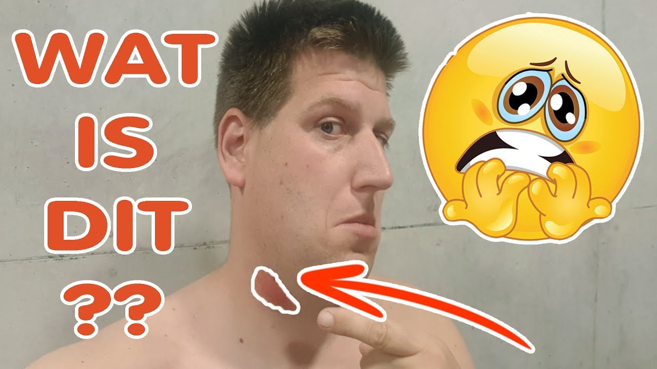 VREEMDE KNOBBEL IN MIJN NEK!! KOETLIFE VLOG - YouTube - Hoe Voelt Een Kwaadaardig Knobbeltje Oksel