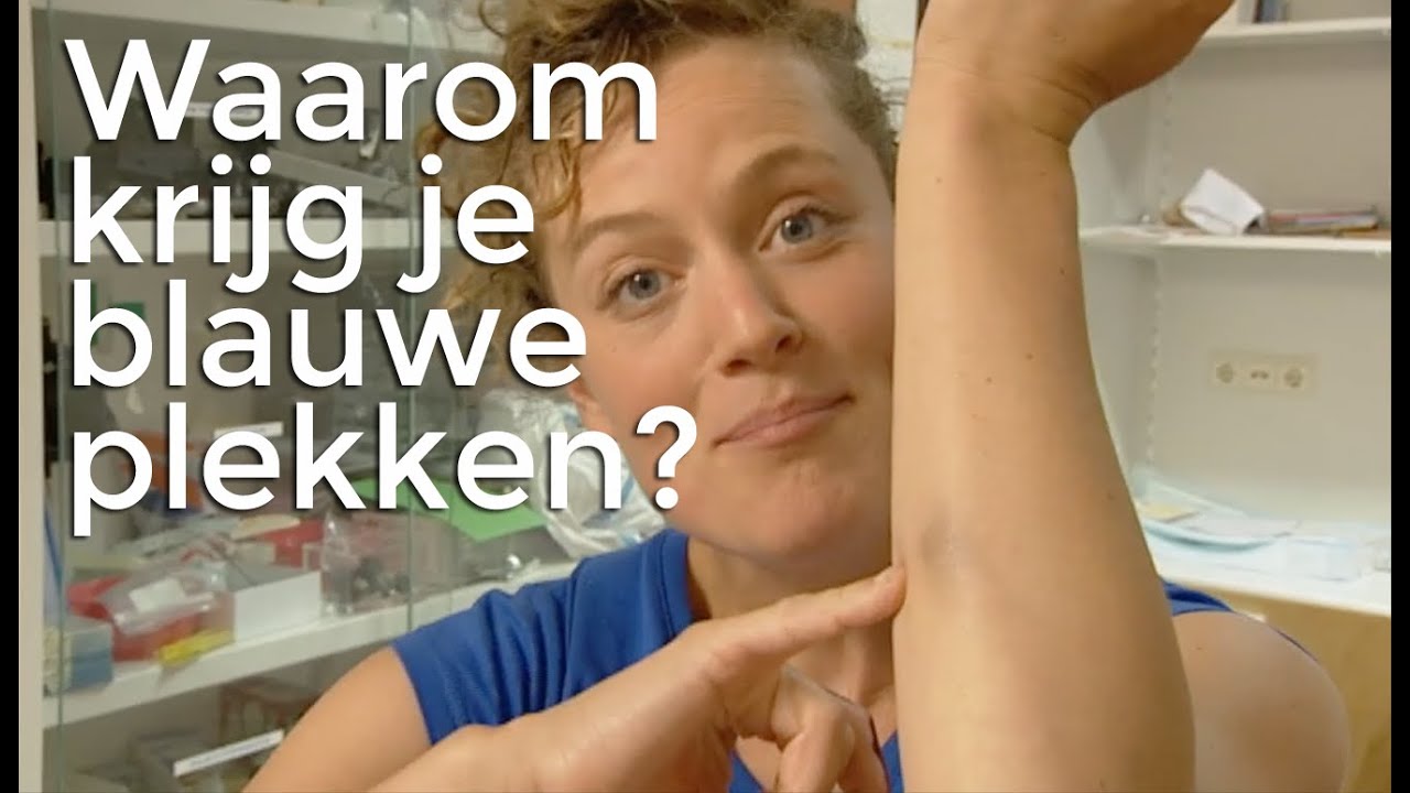 Waarom krijg je blauwe plekken? | Vragen van Kinderen - YouTube - Blauwe Plekken Op Je Lichaam