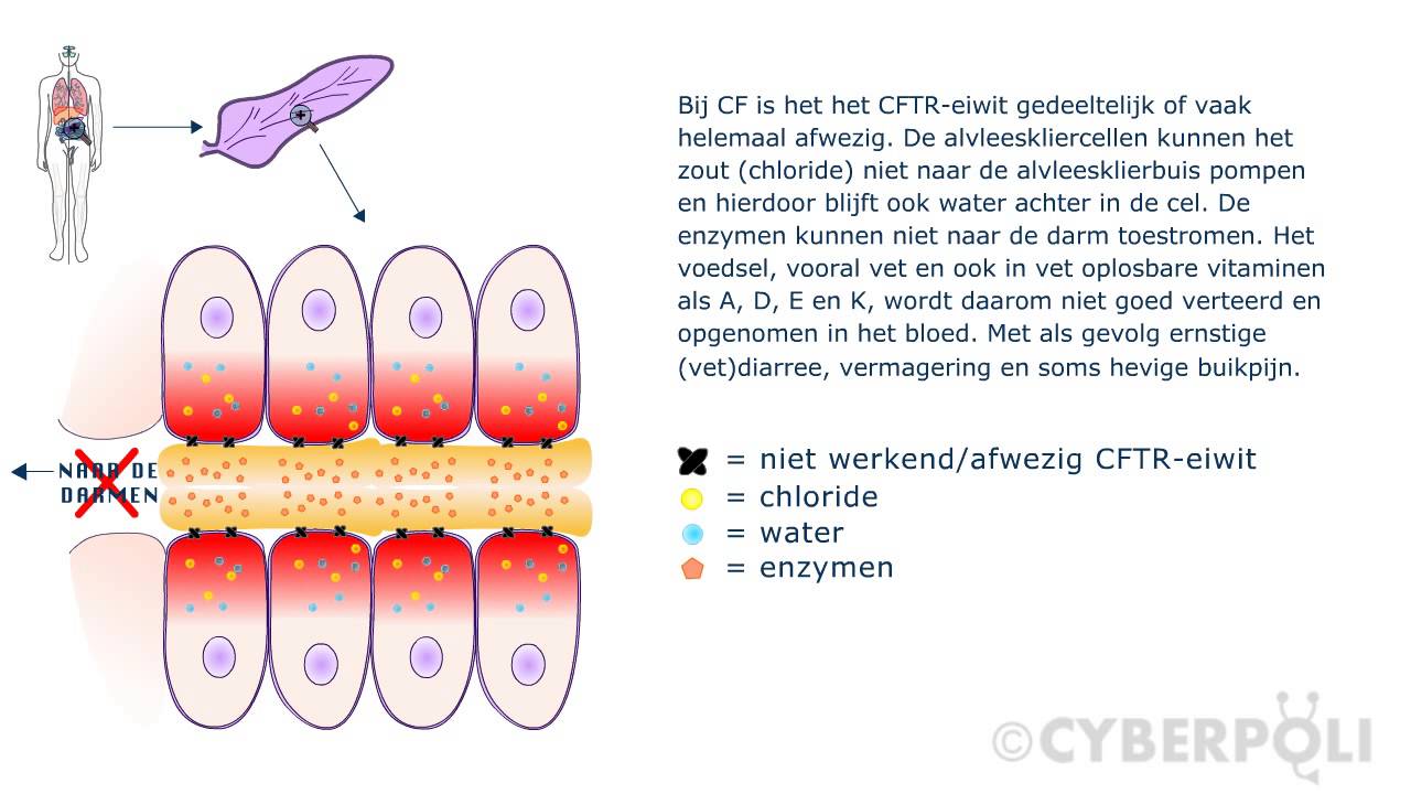 Wat doet CF in de alvleesklier? - YouTube - Aan Welke Kant Zit Je Alvleesklier