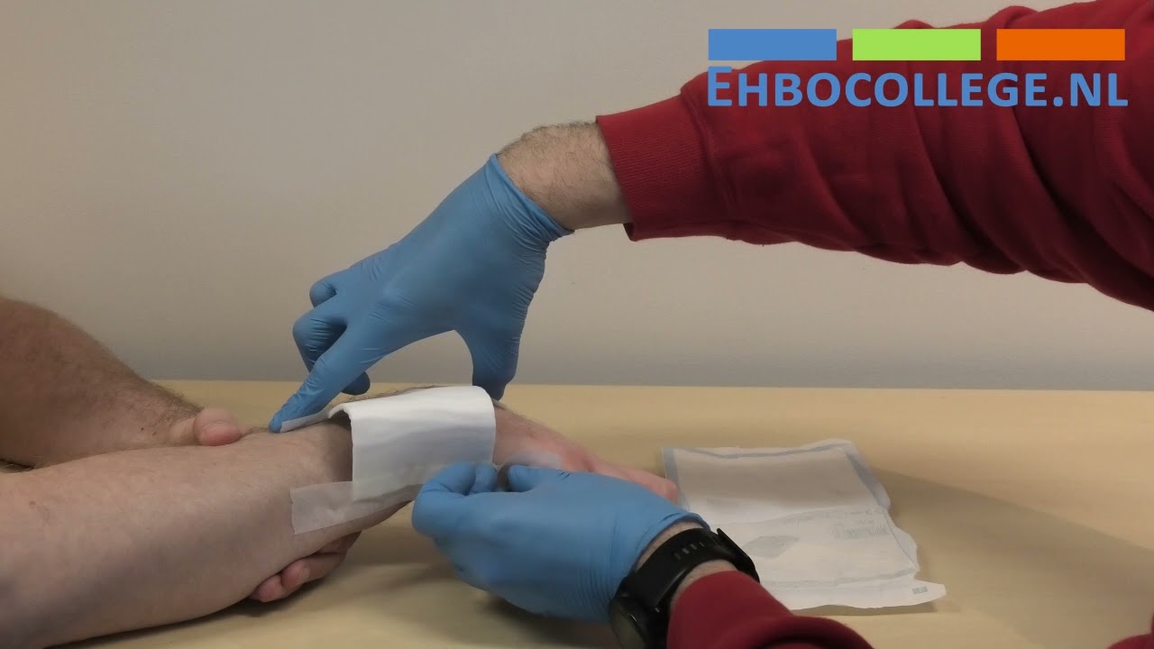 Wat Is Een Open Botbreuk: Kenmerken En Behandeling - Chùa Phước Huệ - Wat Is Een Open Botbreuk