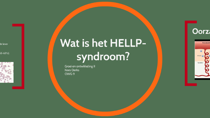 Wat Is Het Hellp Syndroom