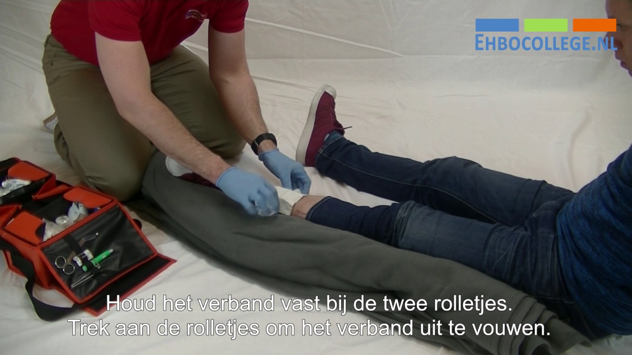 Wat Is Een Open Botbreuk