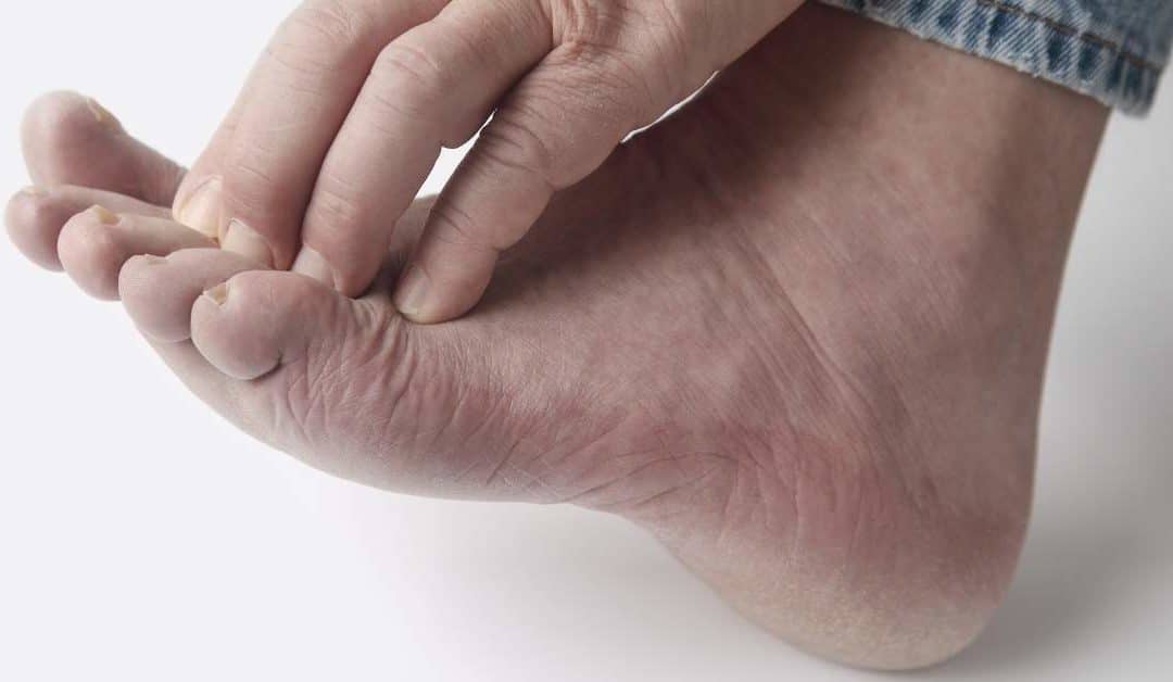 What Causes Peripheral Neuropathy? - Lewis Family Chiropractic - Wat Zijn De Symptomen Van Neuropathie