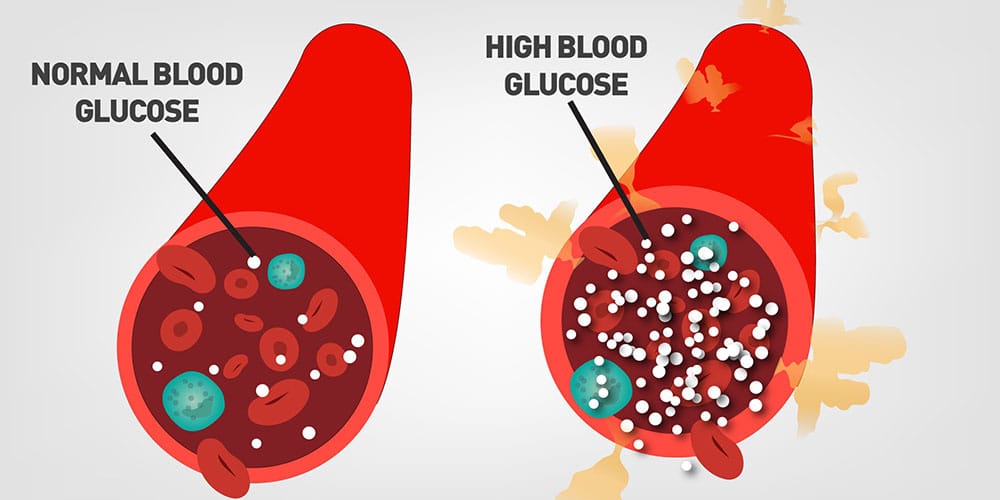 What is blood sugar? | diabetesmagazijn.nl - Wat Doet Suiker Met Je Hersenen