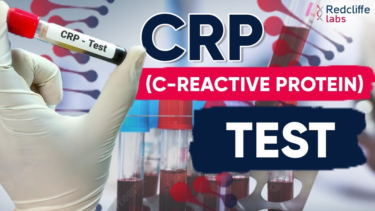 🤔What is CRP (C-Reactive Protein ) Test? | Normal Levels of CRP - Wanneer Antibiotica Bij Verhoogd Crp