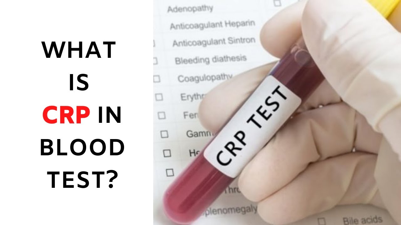 WHAT IS CRP IN BLOOD TEST? - CRP NORMAL RANGE: C Reactive Protein: High - Bloedonderzoek Crp Wat Is Dat