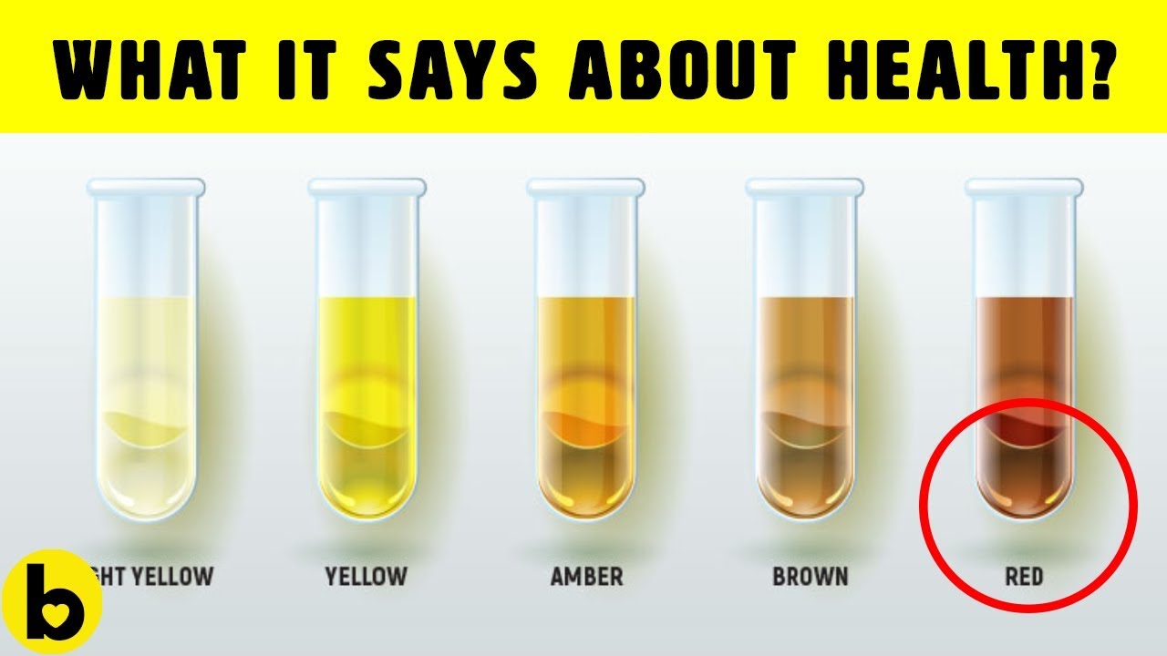 What The Color Of Your Urine Says About Your Health - YouTube - Wat Zegt Creatinine In Urine