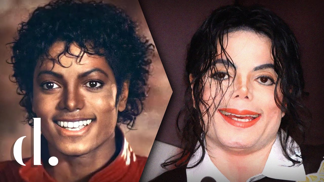 Waar Aan Is Michael Jackson Overleden